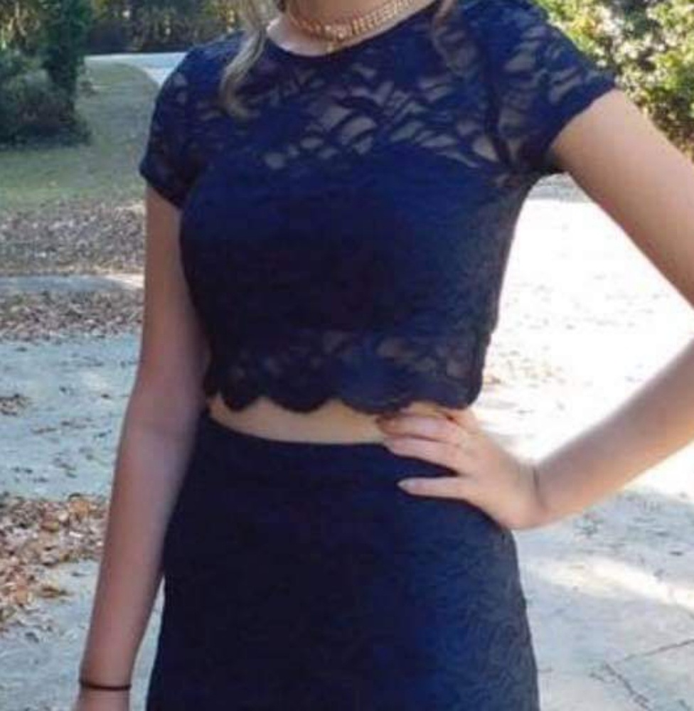xtraordinary lace dress